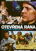 Otevřená rána (DVD) (Il dito nella piaga)